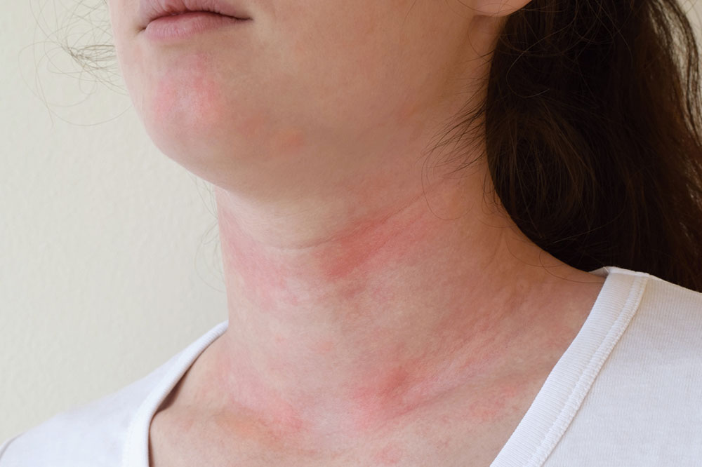 5 Quality Detergents for Sensitive Skin