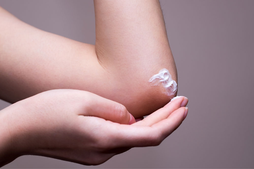 7 Foods to Manage Eczema