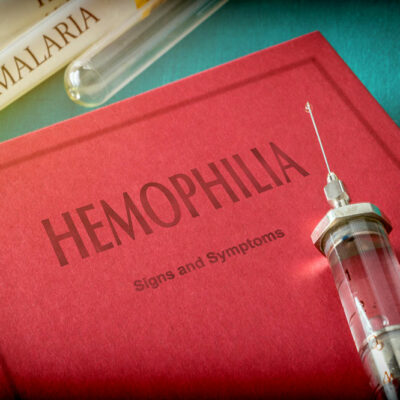 3 Major Symptoms and Early Signs of Hemophilia