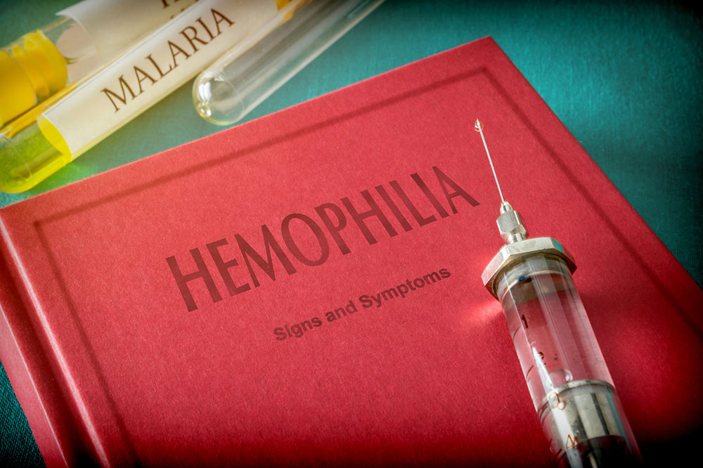 3 Major Symptoms and Early Signs of Hemophilia