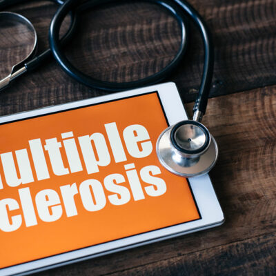 3 Primary Treatment Options for Multiple Sclerosis