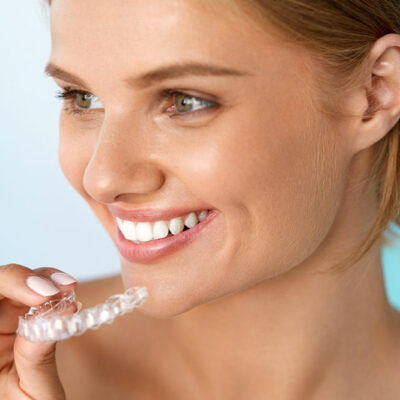 The Clear Benefit of Clear Braces