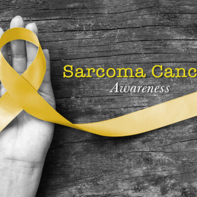 4 Major Risk Factors for Sarcoma