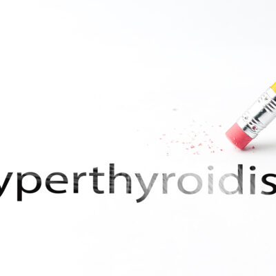 6 Eye Signs of Hyperthyroidism