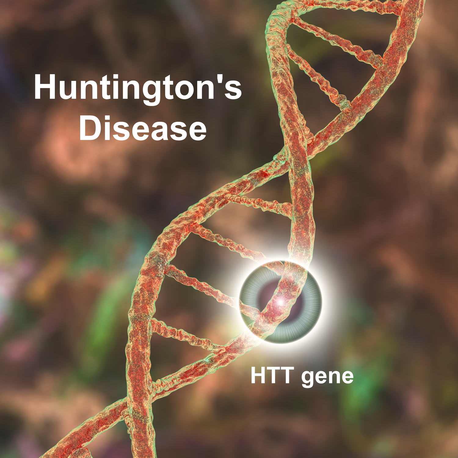The Primary Cause Of Huntington’s Chorea