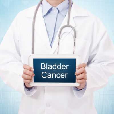 5 Early Warning Signs of Bladder Cancer